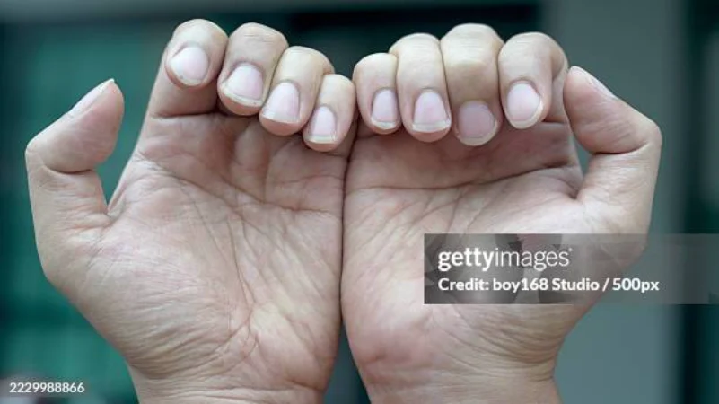 lunula nail health chart